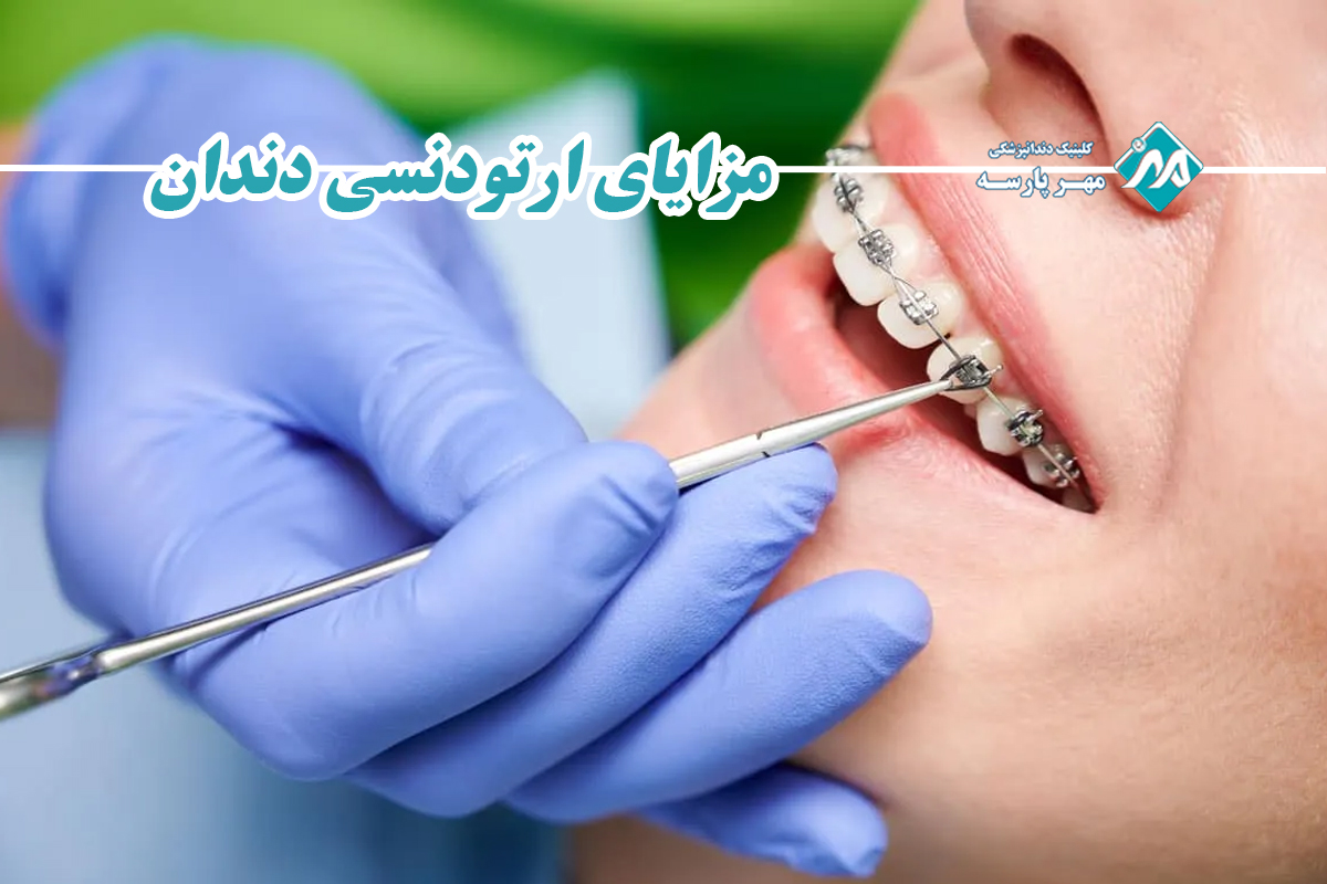 مزایای ارتودنسی دندان