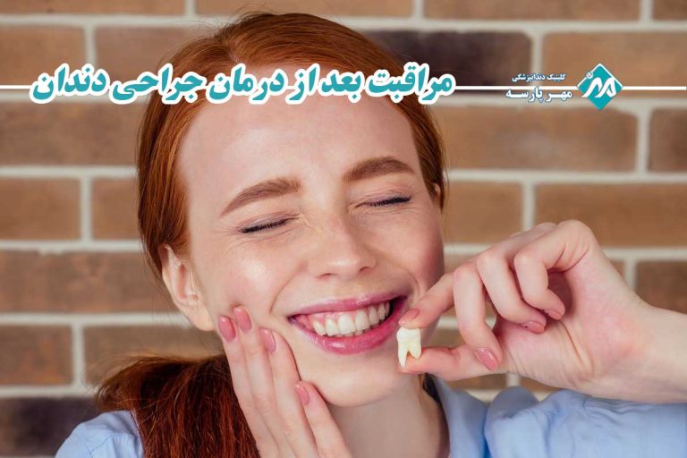 مراقبت بعد از درمان جراحی دندان