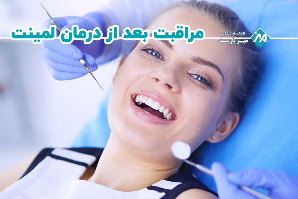 مراقبت بعد از درمان لمینت دندان