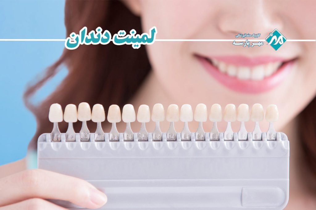 لمینت دندان