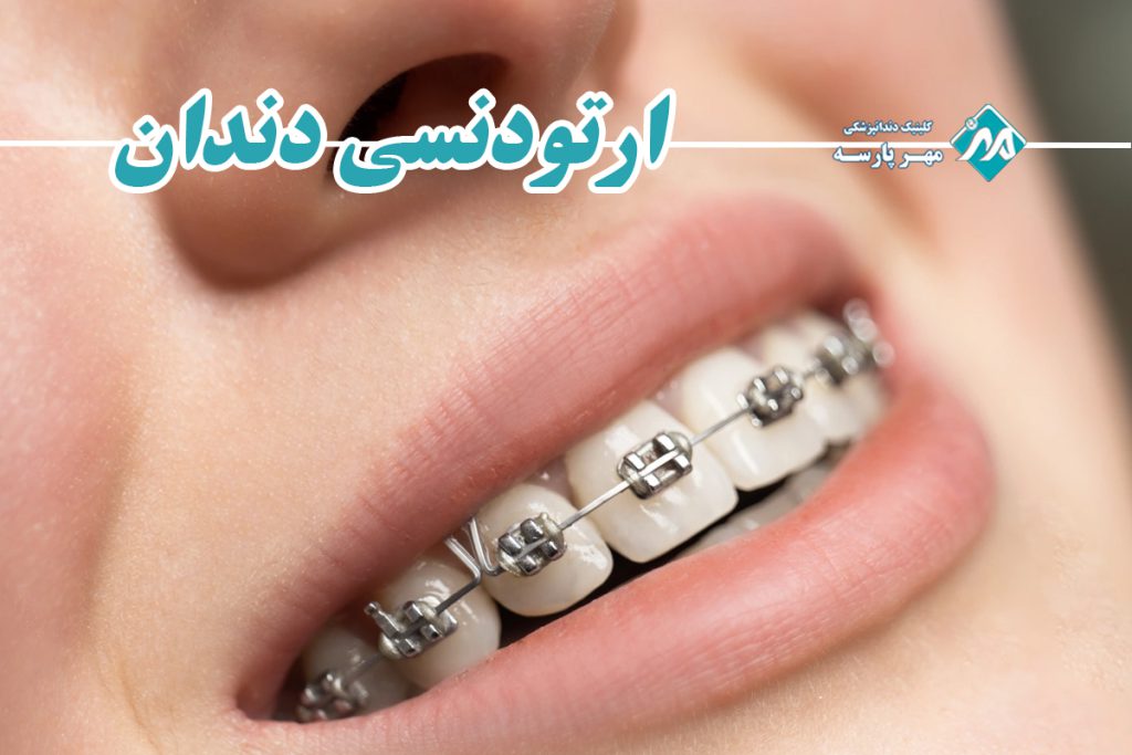 ارتودنسی دندان