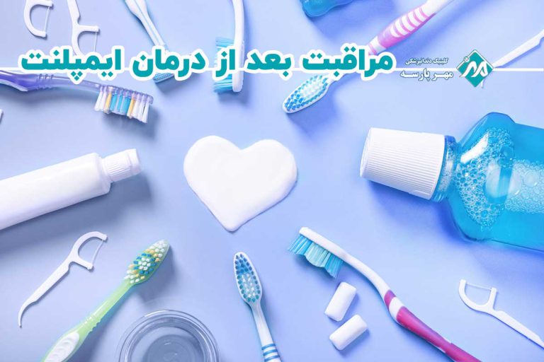 نکات کلیدی مراقبت بعد از درمان ایمپلنت