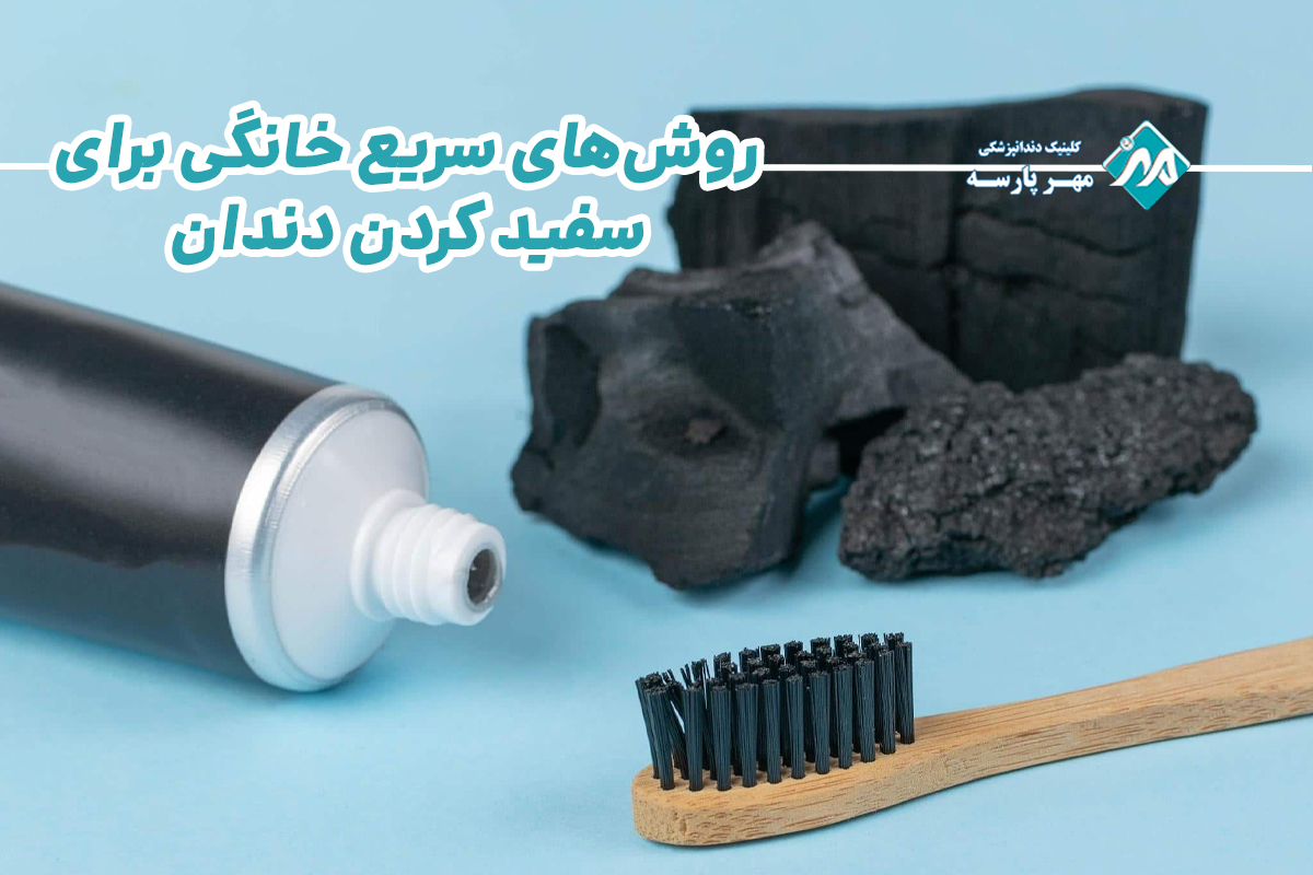 روشهای سریع خانگی برای سفید کردن دندان