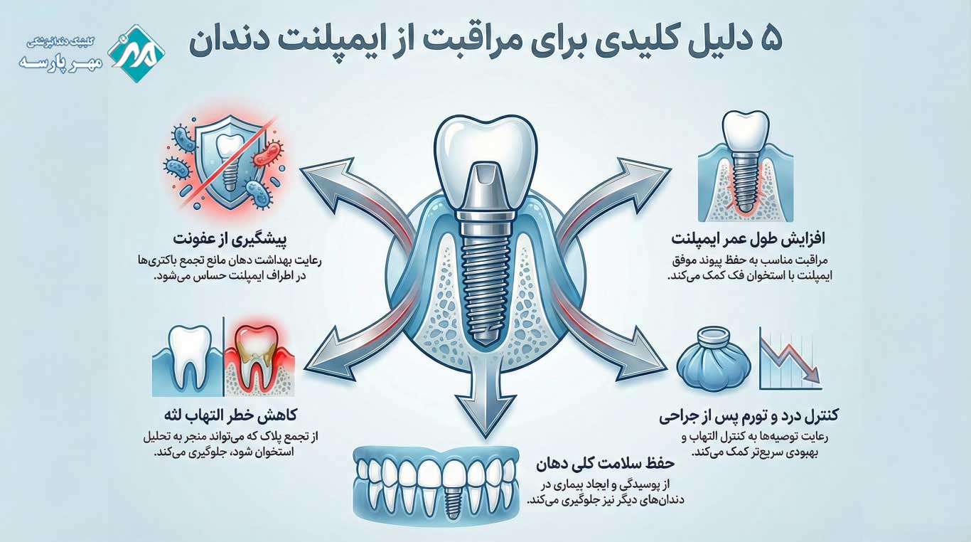 اهمیت مراقبتهای بعد از درمان ایمپلنت