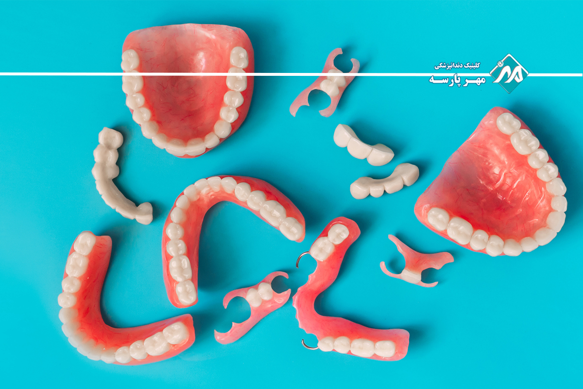 انواع پروتز دندان