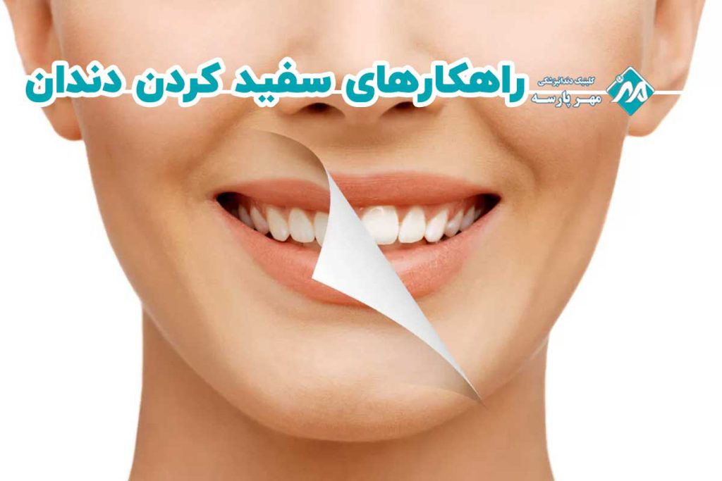 سفید کردن دندان در خانه