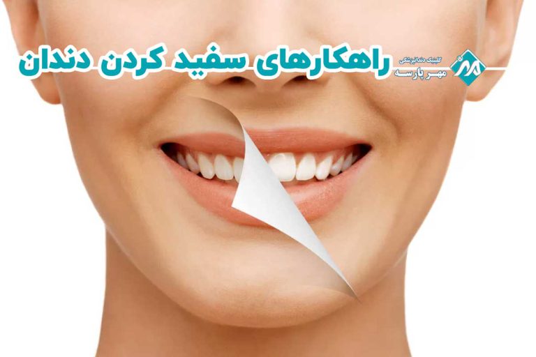 سفید کردن دندان در خانه