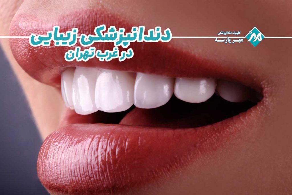 دندانپزشکی زیبایی در غرب تهران