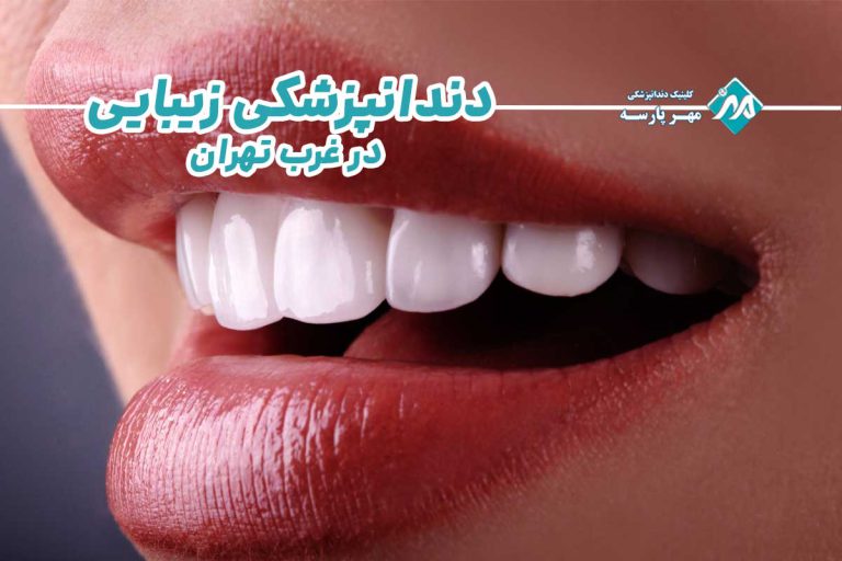 دندانپزشکی زیبایی در غرب تهران