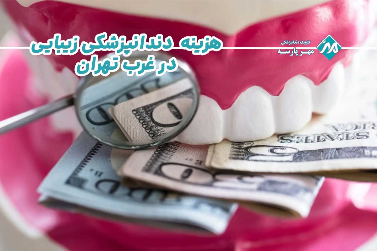 هزینه‌ های دندانپزشکی زیبایی در غرب تهران