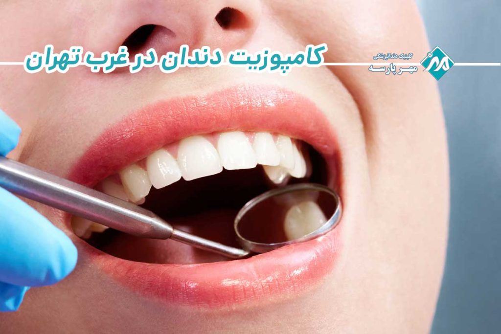 کامپوزیت دندان در غرب تهران
