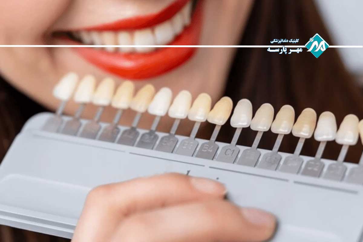 روش‌ های درمانی پرطرفدار دندانپزشکی زیبایی در غرب تهران 