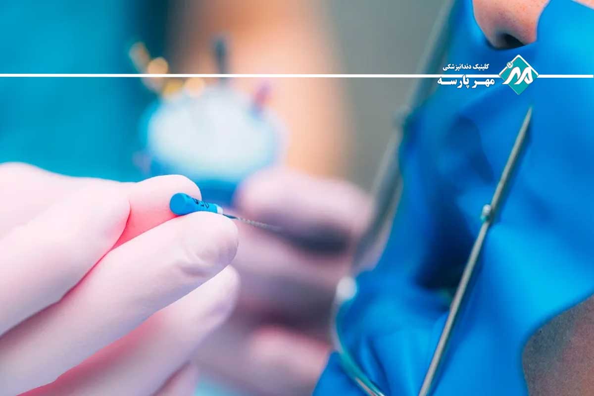 مراحل عصب کشی در غرب تهران در کلینیک مهرپارسه