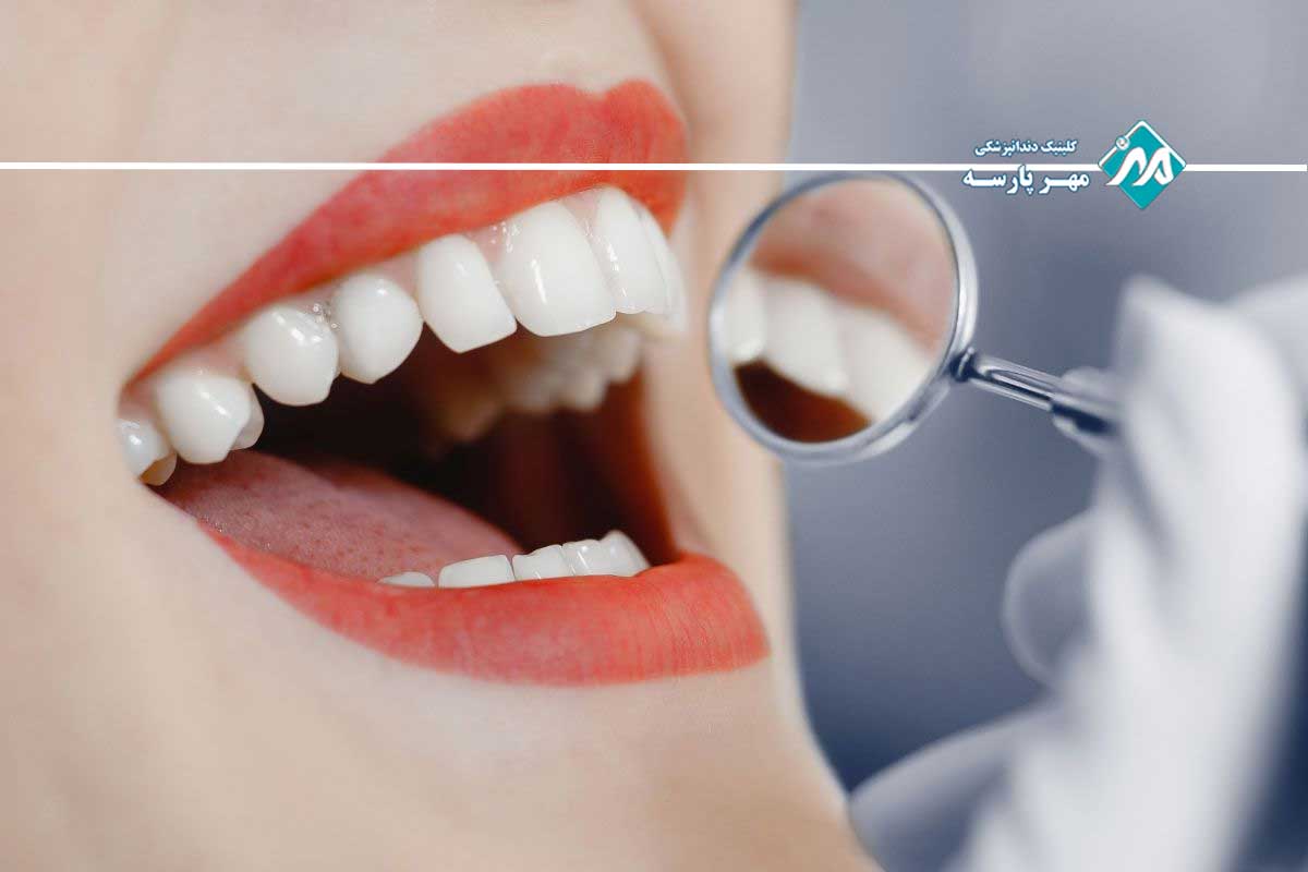 بهترین دندانپزشک زیبایی 
