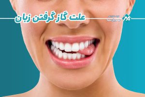 علت گاز گرفتن زبان
