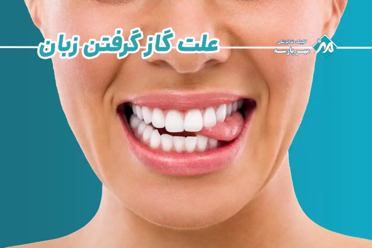 علت گاز گرفتن زبان