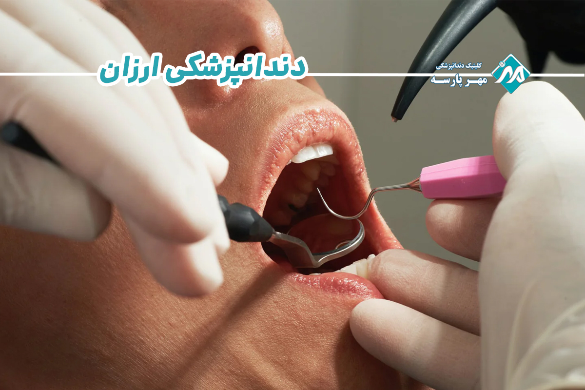 دندانپزشکی ارزان 