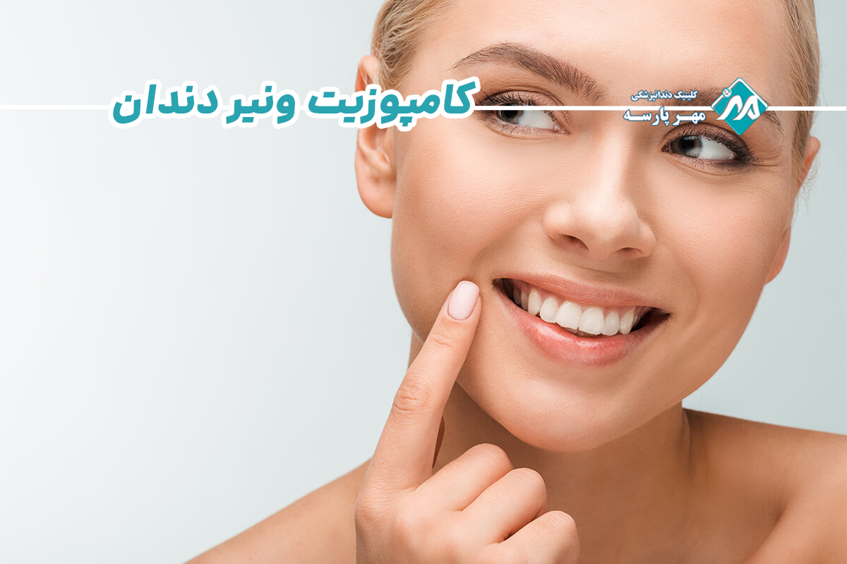 کامپوزیت ونیر دندان در غرب تهران
