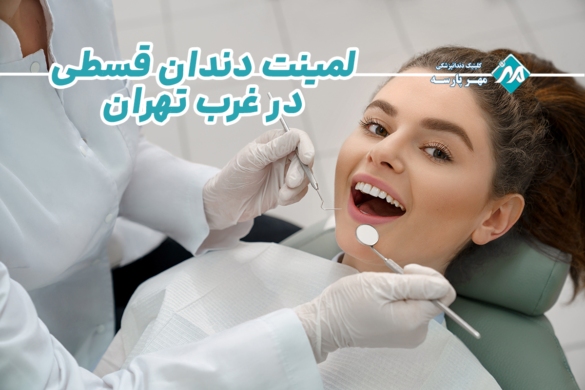 لمینت دندان قسطی در غرب تهران
