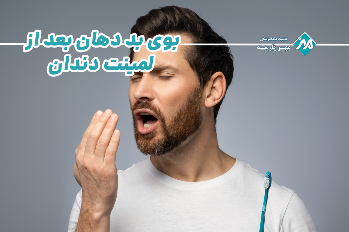 بوی بد دهان بعد از لمینت دندان