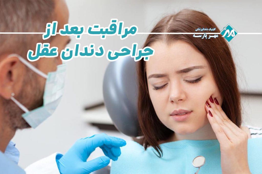 مراقبت بعد از جراحی دندان عقل