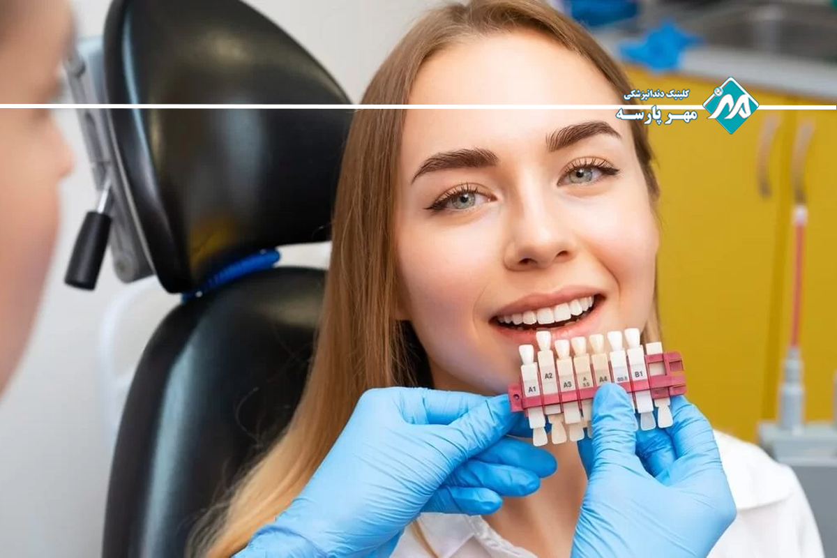 عوارض لمینت