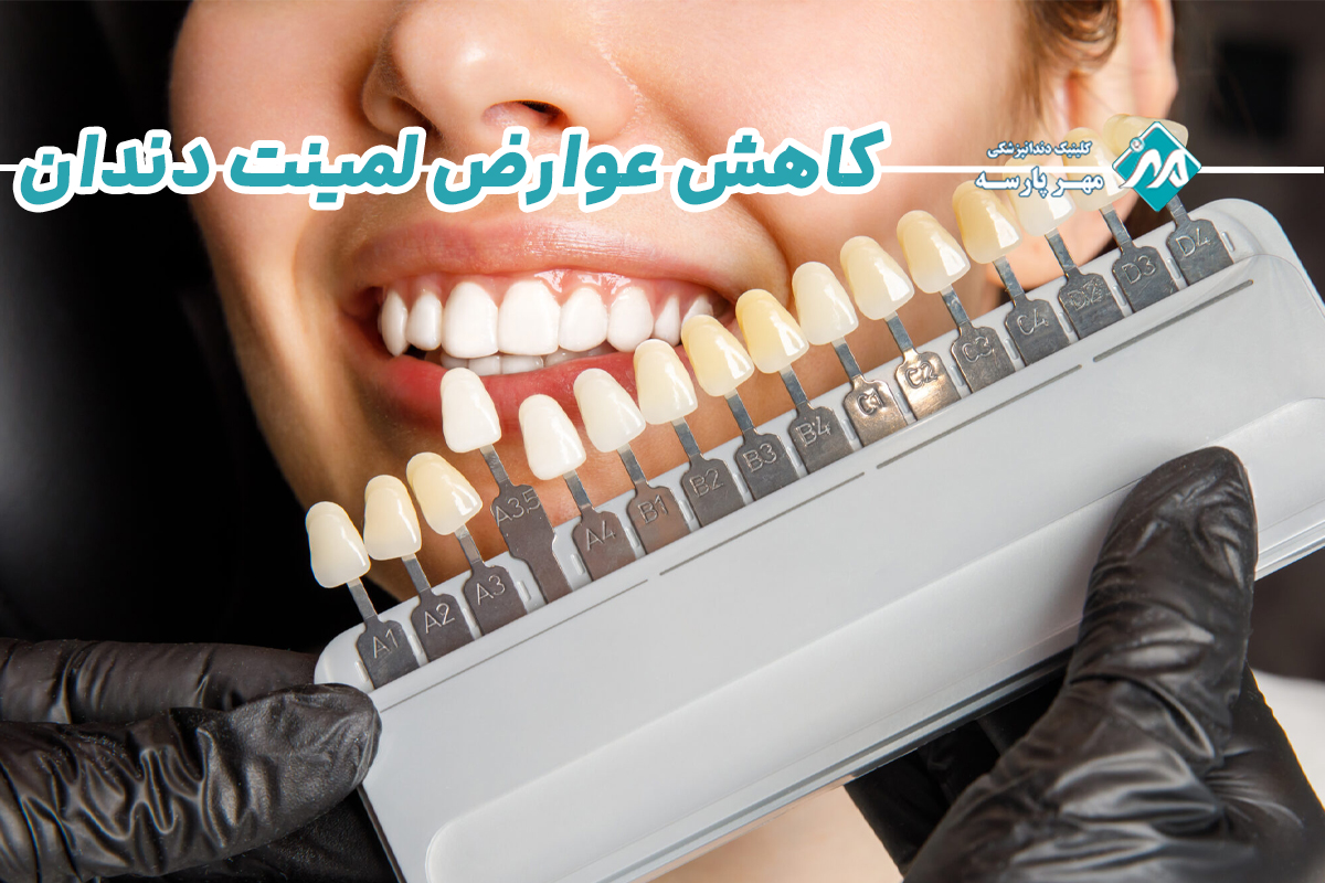کاهش عوارض لمینت دندان