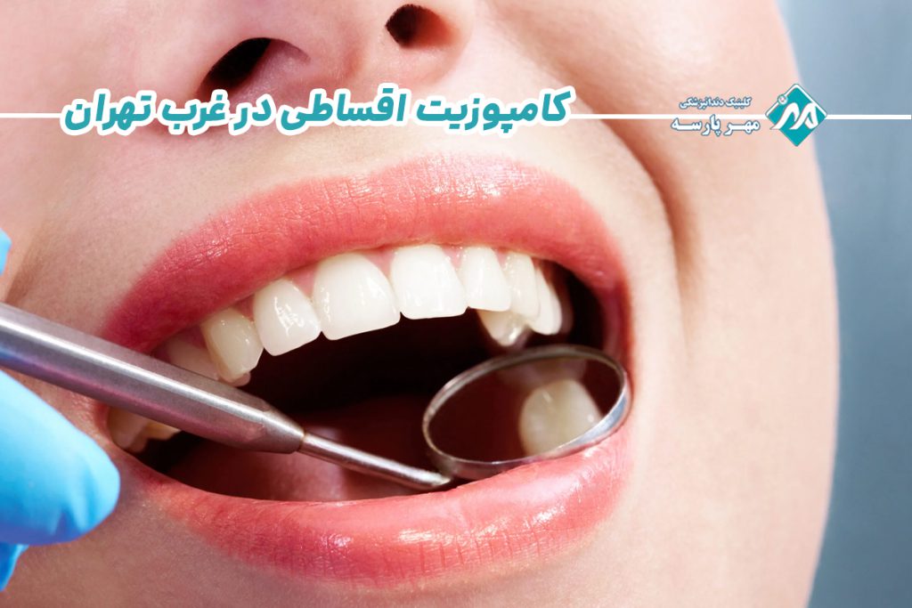 کامپوزیت اقساطی در غرب تهران