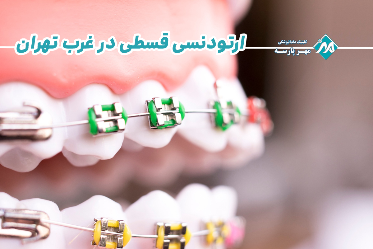 ارتودنسی قسطی در غرب تهران