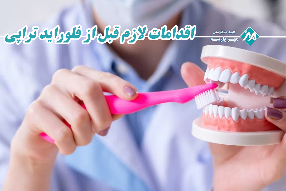 اقدامات لازم قبل از فلوراید تراپی