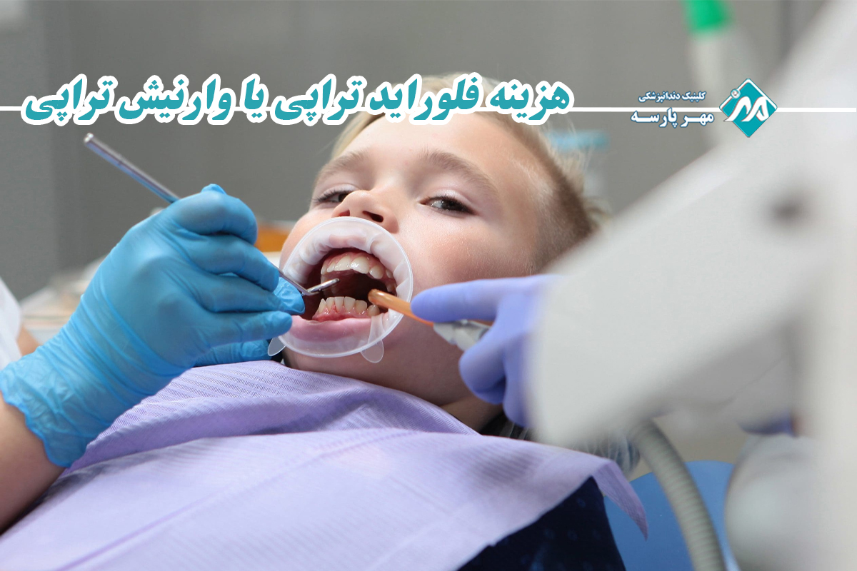 هزینه فلوراید تراپی یا وارنیش تراپی