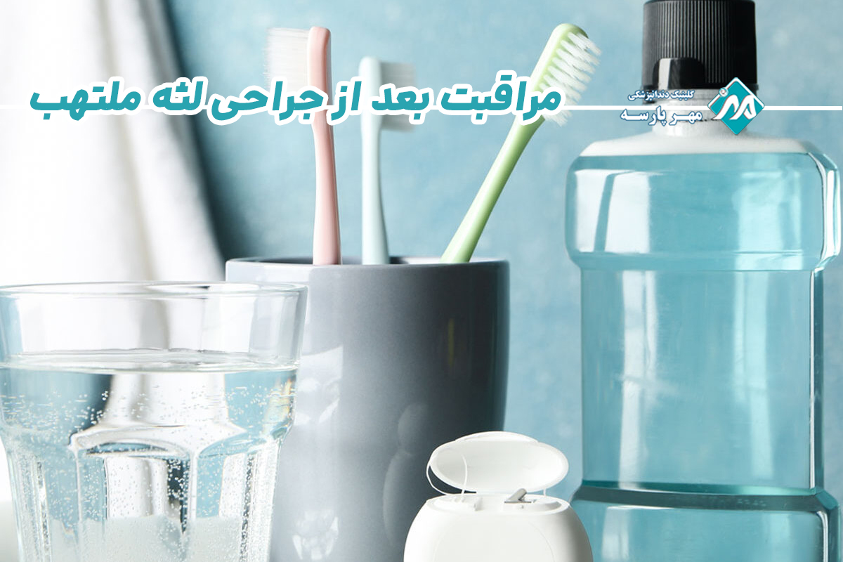 مراقبت بعد از جراحی لثه ملتهب 