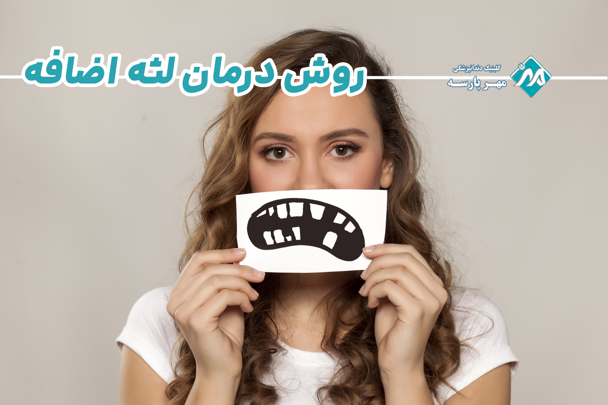 روش درمان لثه اضافه