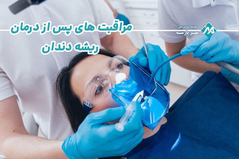 مراقبت های پس از درمان ریشه دندان