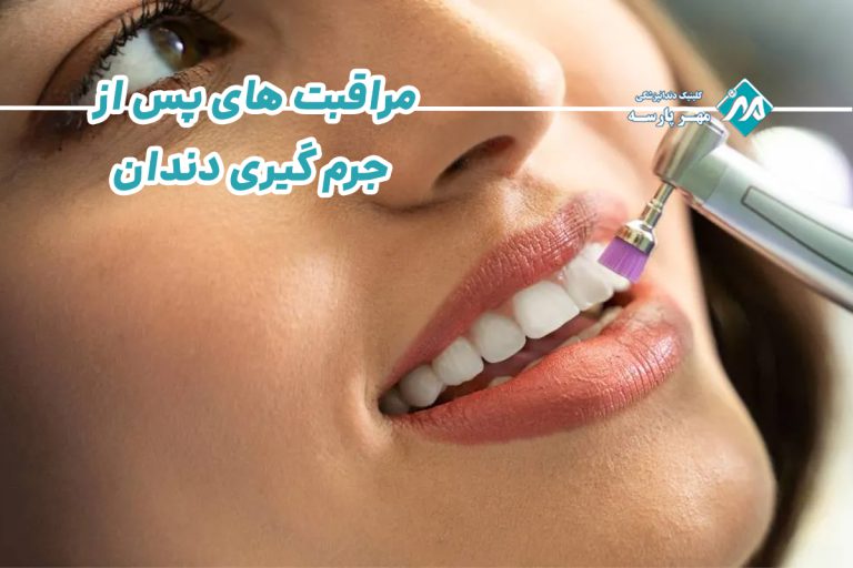 مراقبت های پس از جرم گیری دندان