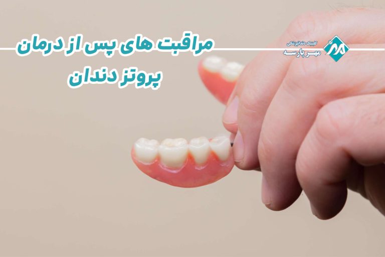 مراقبت های پس از درمان پروتز دندان