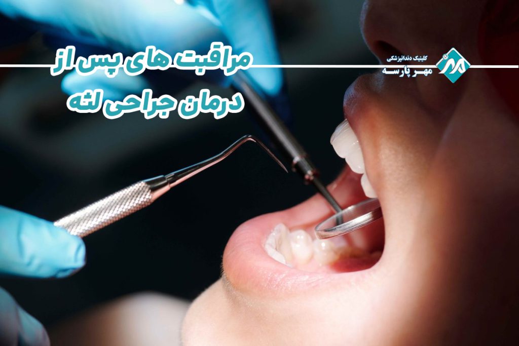  مراقبت های پس از درمان جراحی لثه