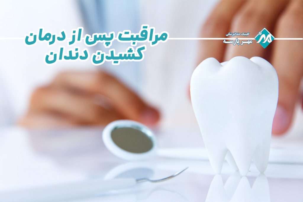مراقبت پس از درمان کشیدن دندان