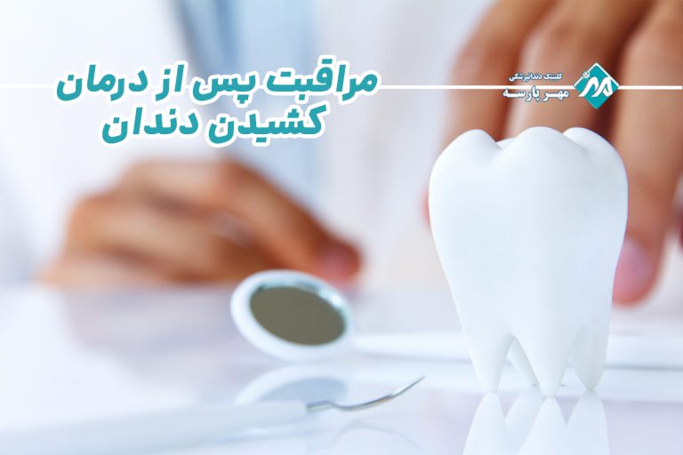مراقبت پس از درمان کشیدن دندان