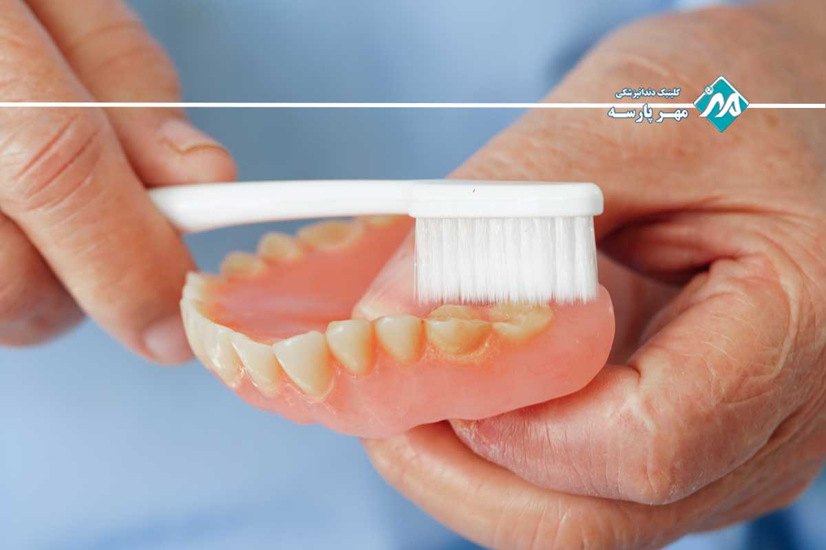 روشهای حرفهای سفید کردن پروتز دندان
