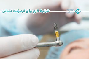شرایط لازم برای ایمپلنت دندان