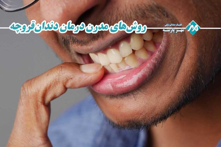 دندانقروچه