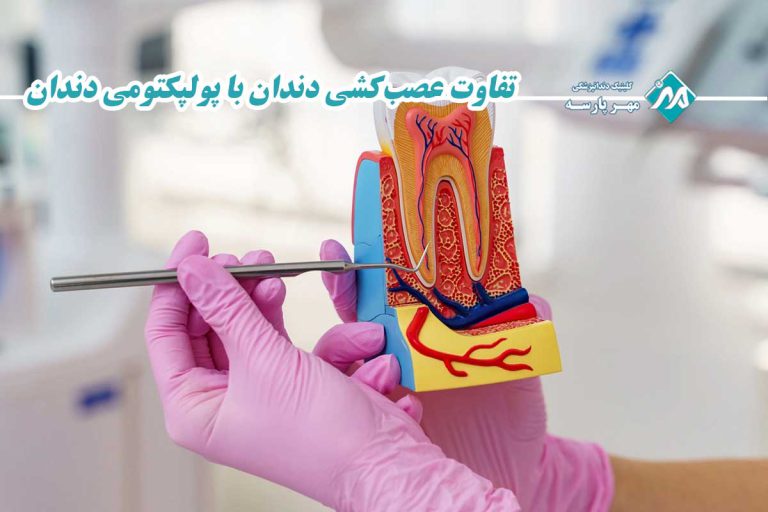 تفاوت عصبکشی دندان با پولپکتومی دندان