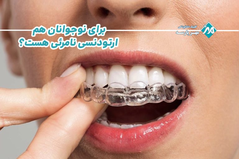 ارتودنسی نامرئی