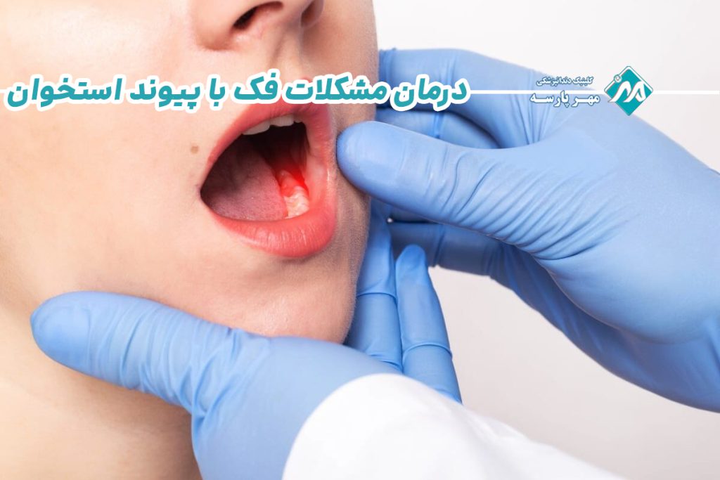 درمان مشکلات فک با پیوند استخوان