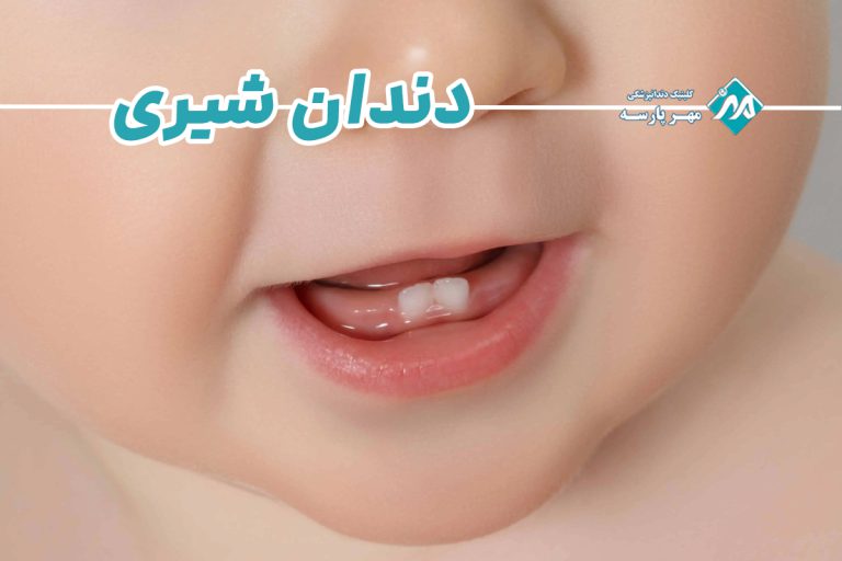 دندان شیری