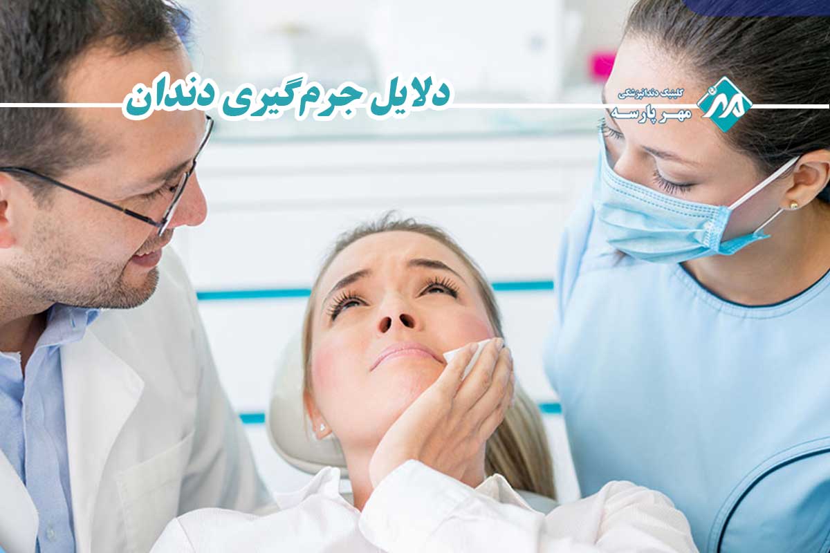 جرم گیری