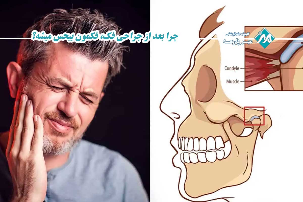 چرا بعد از جراحی فک دچار بی‌حسی می‌شویم؟ (کالبدشکافی یک عارضه)