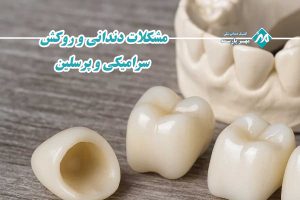 مشکلات دندانی و روکش سرامیکی و پرسلین