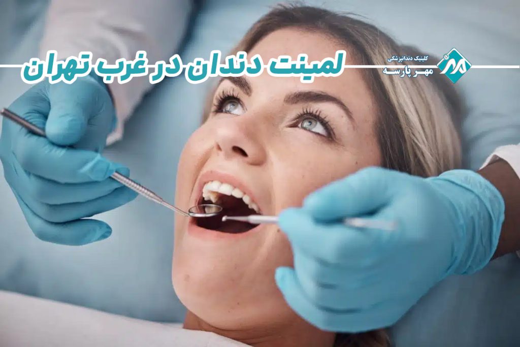 لمینت دندان در غرب تهران